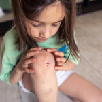 Luka Kecil, Perawatan Besar: Cara Santai Merawat Luka agar Cepat Pulih